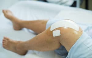 knee